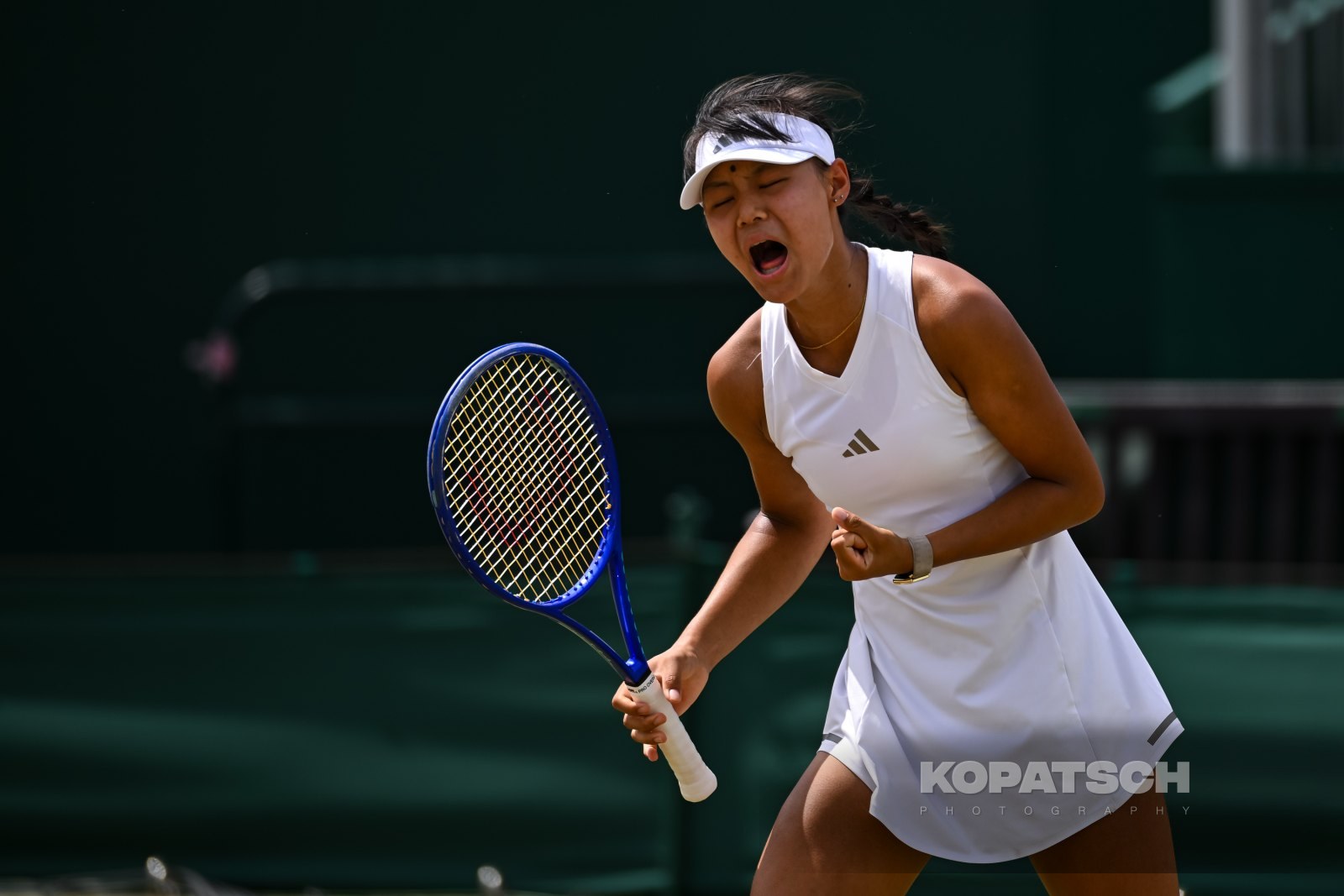 Xinran Sun of China — 2026 Wimbledon